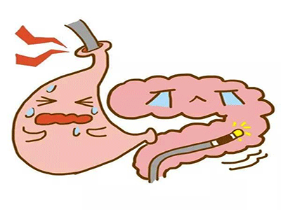 胃肠息肉的概念 不同类型息肉的病因