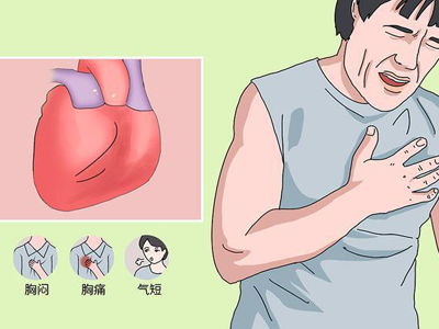 这些症状居然是心绞痛 早期筛查做哪些检查