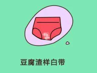 女性私处出现“豆腐渣白带” 当心是这类妇科疾病