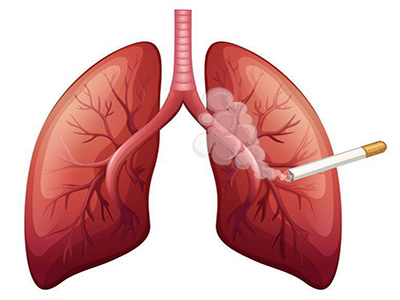 常抽烟的人需要做哪些体检项目
