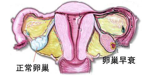 卵巢功能检查的方法