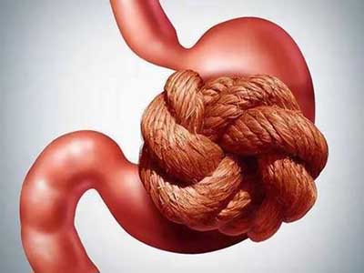 慢性非萎缩性胃炎的病因是什么?