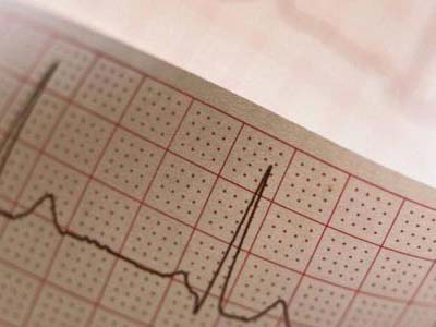 心电图正常，代表心脏一切正常吗？