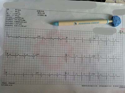心电图正常，代表心脏一切正常吗？