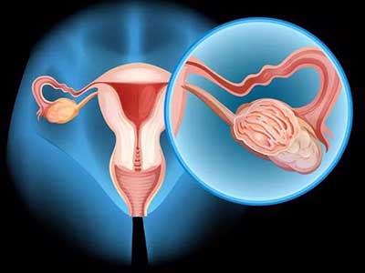 女性卵巢如何保养？有哪些禁忌注意事项？