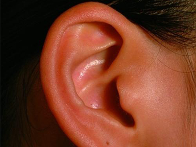 想要预防耳道瘙痒，该怎么做？