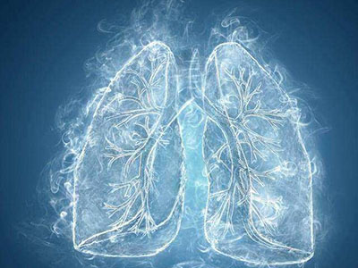 肺癌筛查需要做哪些检查项目？