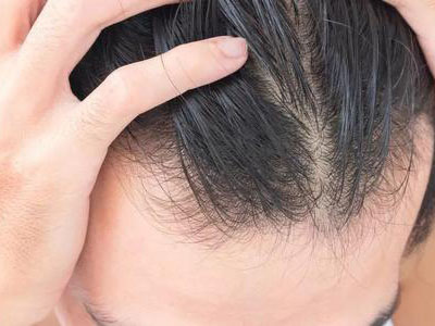 女性脱发六大因素，避开它保护好你的秀发！