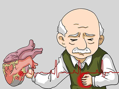 老年人动脉硬化该怎么办？