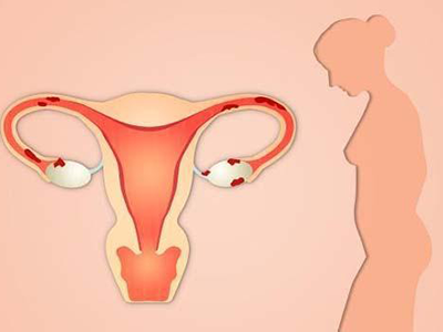 诊断女性卵巢早衰的症状
