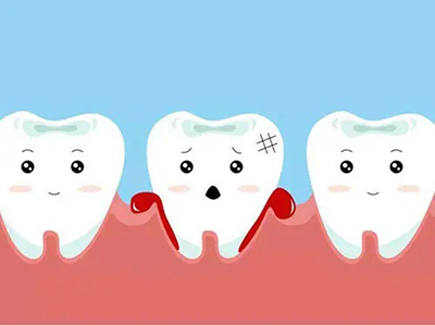 经常刷牙出血一定是牙龈的问题么？