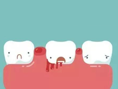 经常刷牙出血一定是牙龈的问题么？