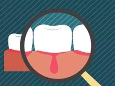 牙龈出血如何预防？