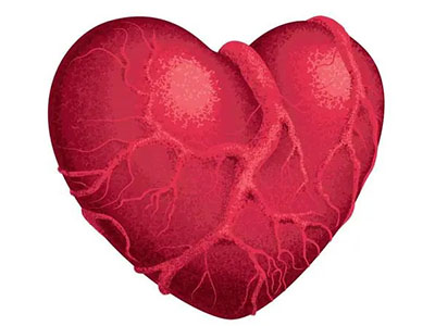 风湿性心脏病需要做哪些检查？