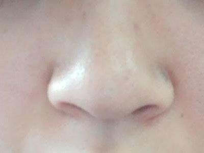 鼻子内部痛是什么原因？