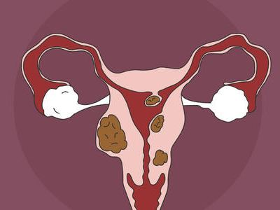 卵巢早衰是由哪些因素造成的
