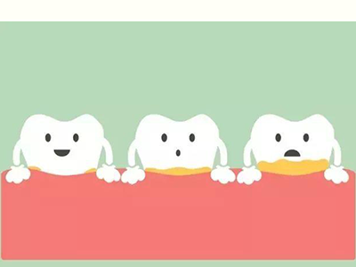 牙结石需要做哪些检查？