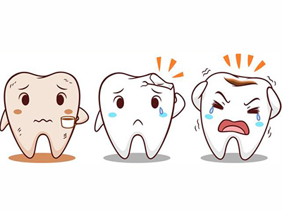 牙结石需要做哪些检查？