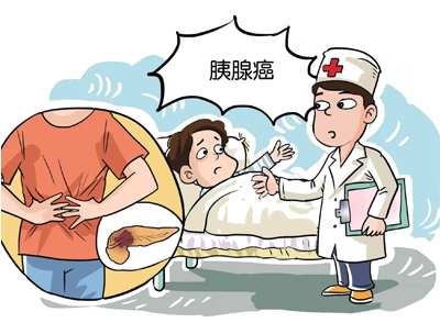 胰腺癌是什么 出现这些症状小心胰腺癌