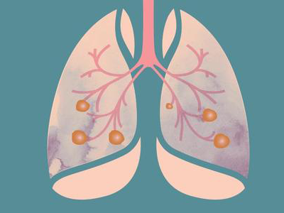 在龙岩哪些医院可以做肺部CT。