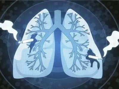 在青岛有哪些医院可以做肺部CT(附可约机构）