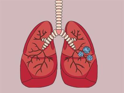 想在舟山做肺部CT，有哪些医院可以去。