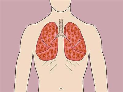 在宁波有哪些医院可以提供肺部CT检查（高质量医院推荐）